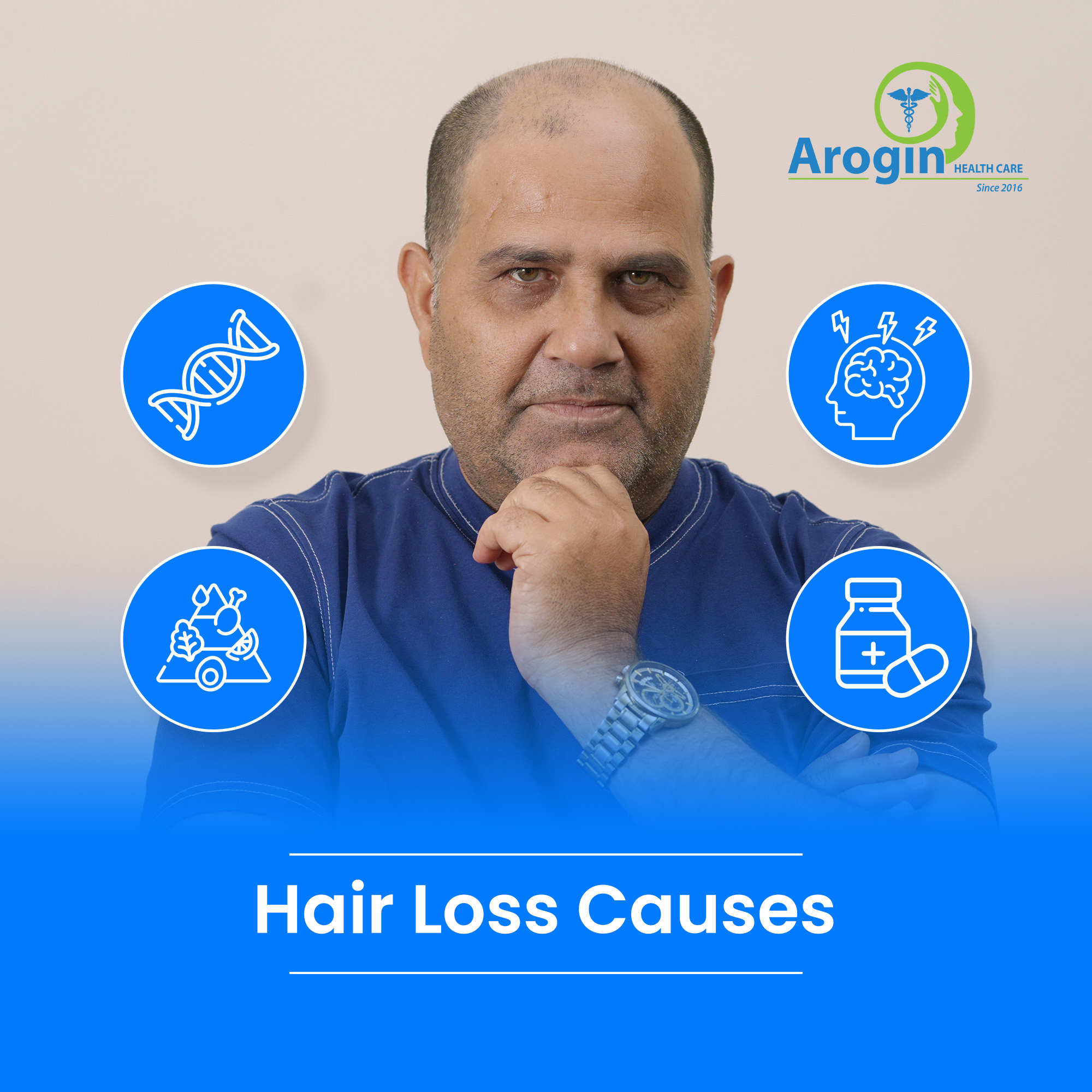 Hair Loss Causes